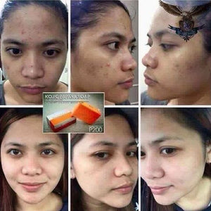 Nlighten Kojic Papaya With Glutathione
