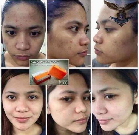 Nlighten Kojic Papaya With Glutathione