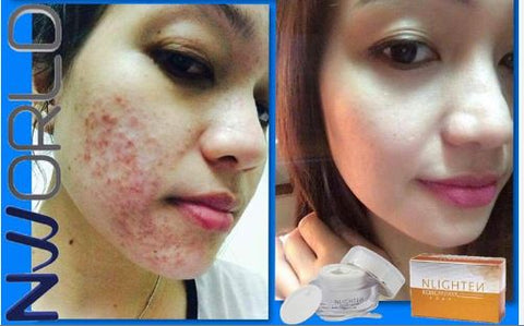 Nlighten Kojic Papaya With Glutathione