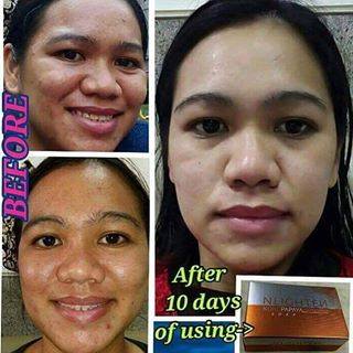 Nlighten Kojic Papaya With Glutathione