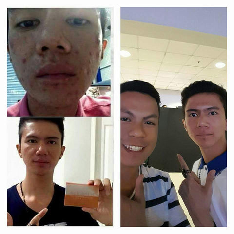 Nlighten Kojic Papaya With Glutathione